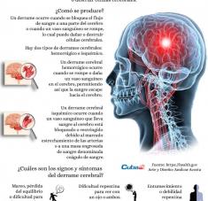 Infografía derrame cerebral cuba