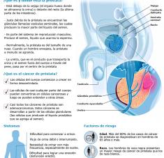 Infografia 11 de junio dia mundia del cancer de prostata