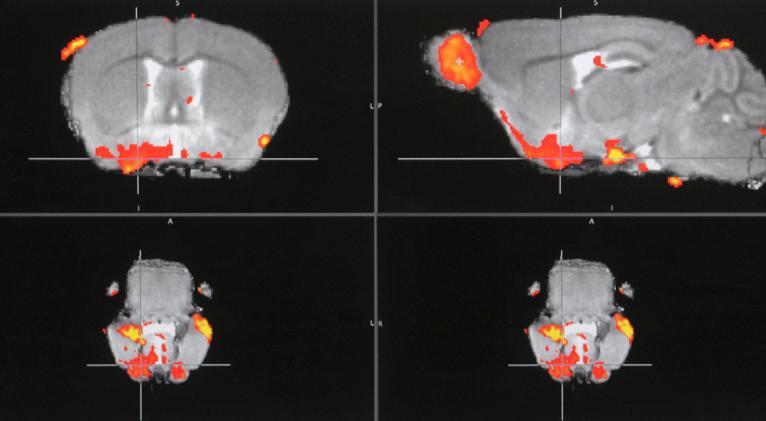 Imágenes de resonancia magnética del cerebro de ratón. Greg Sorber / www.globallookpress.com