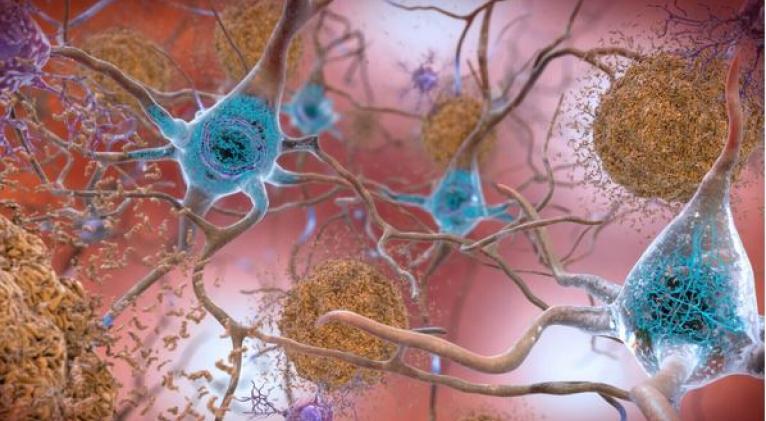 AP Photo / Uncredited/National Institute on Aging, NIH