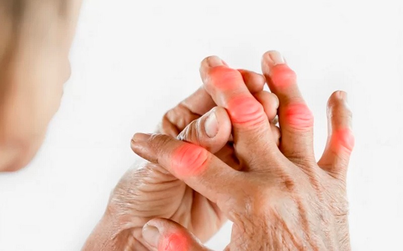 Hands suffering from arthritis