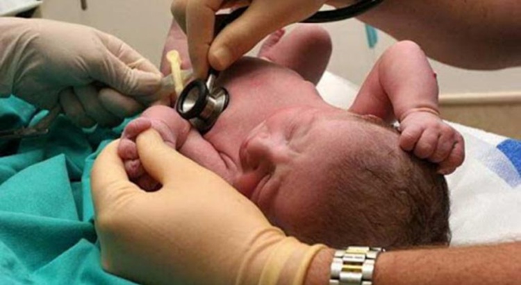 Manos de personal médico atendiendo a recién nacido Manos de personal médico atendiendo a recién nacido