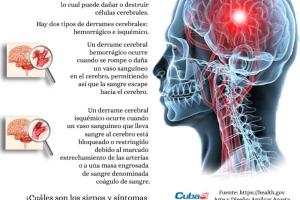 ¿Qué hacer si sospecha que sufre un derrame cerebral?