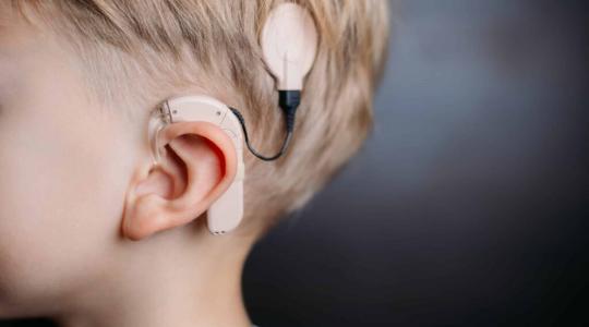 Implantes cocleares